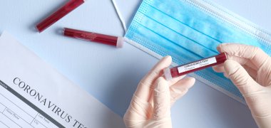 Coronavirus blood test concept. Doctor hands in medical gloves holding test tube with blood for Coronavirus analysis over laboratory desk. 2019-nCoV Coronavirus originating in Wuhan, China